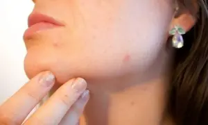 Dedo con uñas brillantes toca la barbilla, notando un molesto grano que no se va. Pendiente de fantasía adorna la oreja.