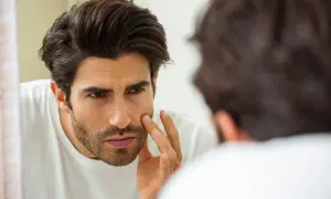 Hombre se examina la cara en el espejo, preocupado por la dermatitis en la barba.