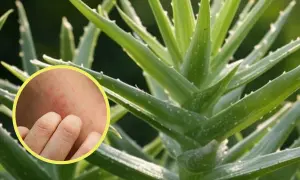 Primer plano de una planta de aloe vera con un círculo que muestra una piel irritada y enrojecida, sugiriendo contraindicaciones del aloe vera en la piel.