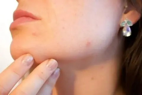 Dedo con uñas brillantes toca la barbilla, notando un molesto grano que no se va. Pendiente de fantasía adorna la oreja.