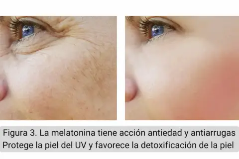 Comparación de piel con arrugas y piel lisa tras uso de melatonina tópica. Reduce líneas de expresión y protege del sol.