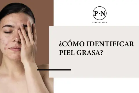 Una joven con acné se cubre el rostro, mientras el texto pregunta: ¿cómo saber si tienes piel grasa?