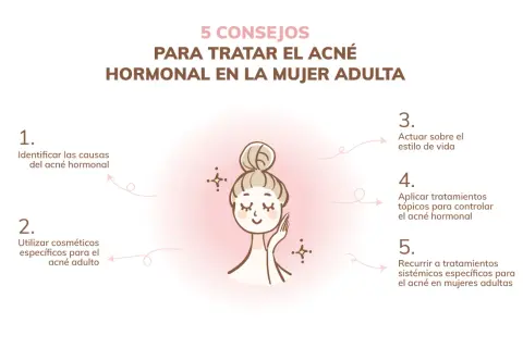 Cinco consejos para tratar el acné hormonal en mujeres adultas: identificar causas, usar cosméticos específicos, actuar sobre el estilo de vida, aplicar tratamientos tópicos y sistémicos.