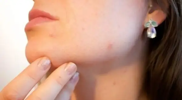 Dedo con uñas brillantes toca la barbilla, notando un molesto grano que no se va. Pendiente de fantasía adorna la oreja.