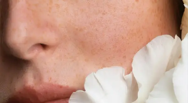 Piel con pecas y pétalos blancos. Las ceramidas para que sirve: restauran la barrera cutánea, hidratan y protegen.