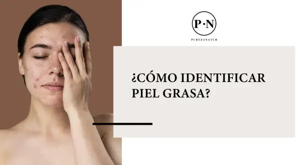 Una joven con acné se cubre el rostro, mientras el texto pregunta: ¿cómo saber si tienes piel grasa?