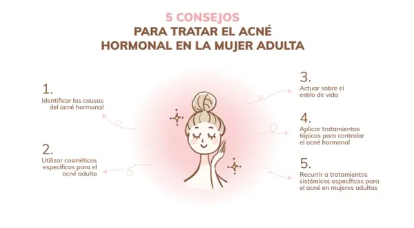 Cinco consejos para tratar el acné hormonal en mujeres adultas: identificar causas, usar cosméticos específicos, actuar sobre el estilo de vida, aplicar tratamientos tópicos y sistémicos.