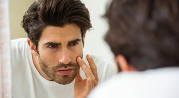 Hombre se examina la cara en el espejo, preocupado por la dermatitis en la barba.
