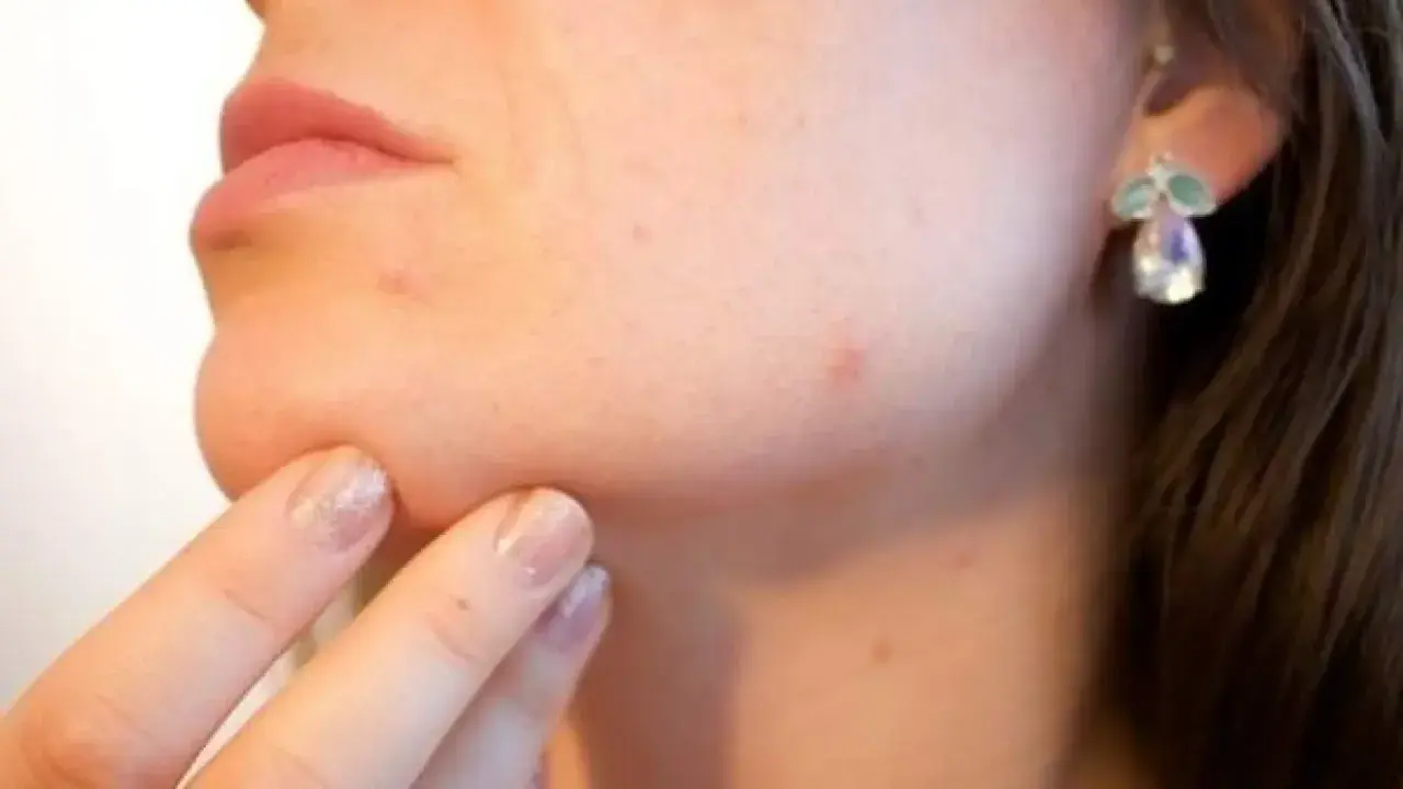 Dedo con uñas brillantes toca la barbilla, notando un molesto grano que no se va. Pendiente de fantasía adorna la oreja.