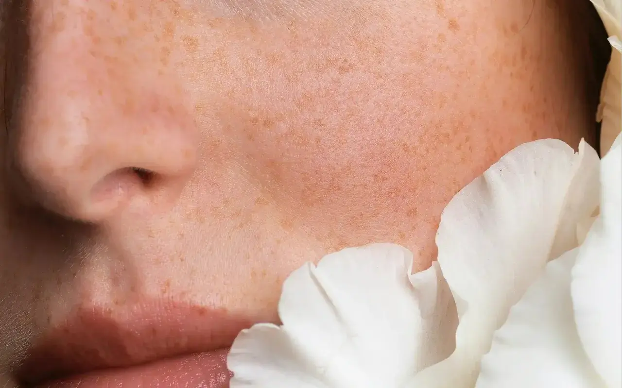 Piel con pecas y pétalos blancos. Las ceramidas para que sirve: restauran la barrera cutánea, hidratan y protegen.