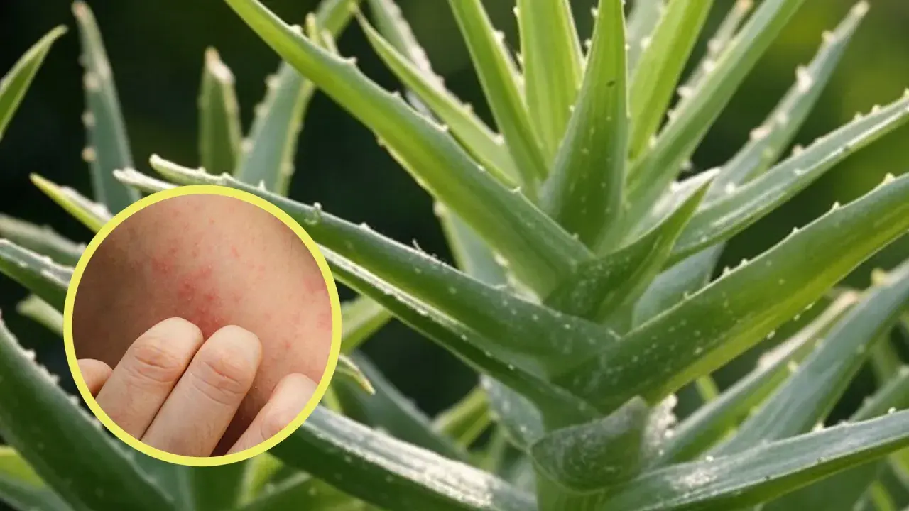Primer plano de una planta de aloe vera con un círculo que muestra una piel irritada y enrojecida, sugiriendo contraindicaciones del aloe vera en la piel.