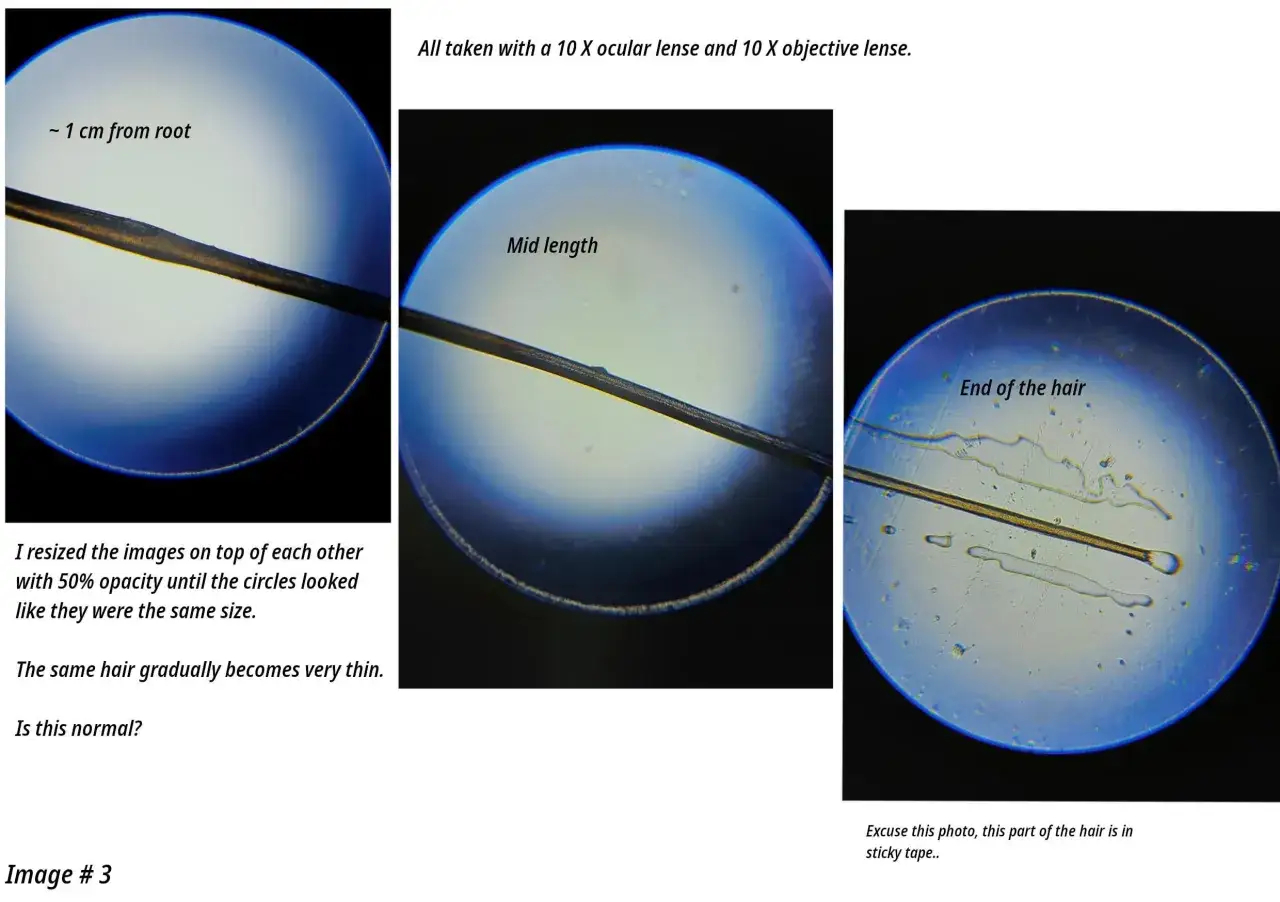 Microscopio muestra que es la cutícula del pelo, observando su grosor desde la raíz hasta la punta.