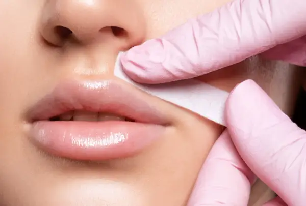 Manos enguantadas retiran banda de cera del labio superior, tratando el melasma bigote.