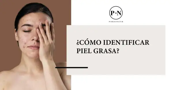 Una joven con acné se cubre el rostro, mientras el texto pregunta: ¿cómo saber si tienes piel grasa?