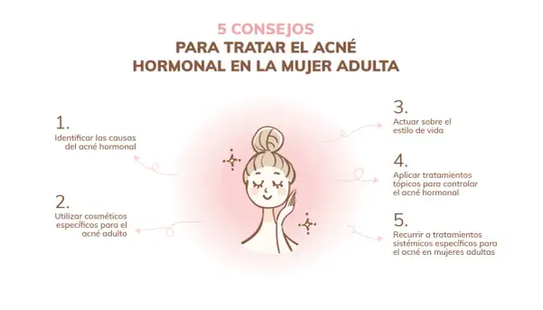 Cinco consejos para tratar el acné hormonal en mujeres adultas: identificar causas, usar cosméticos específicos, actuar sobre el estilo de vida, aplicar tratamientos tópicos y sistémicos.